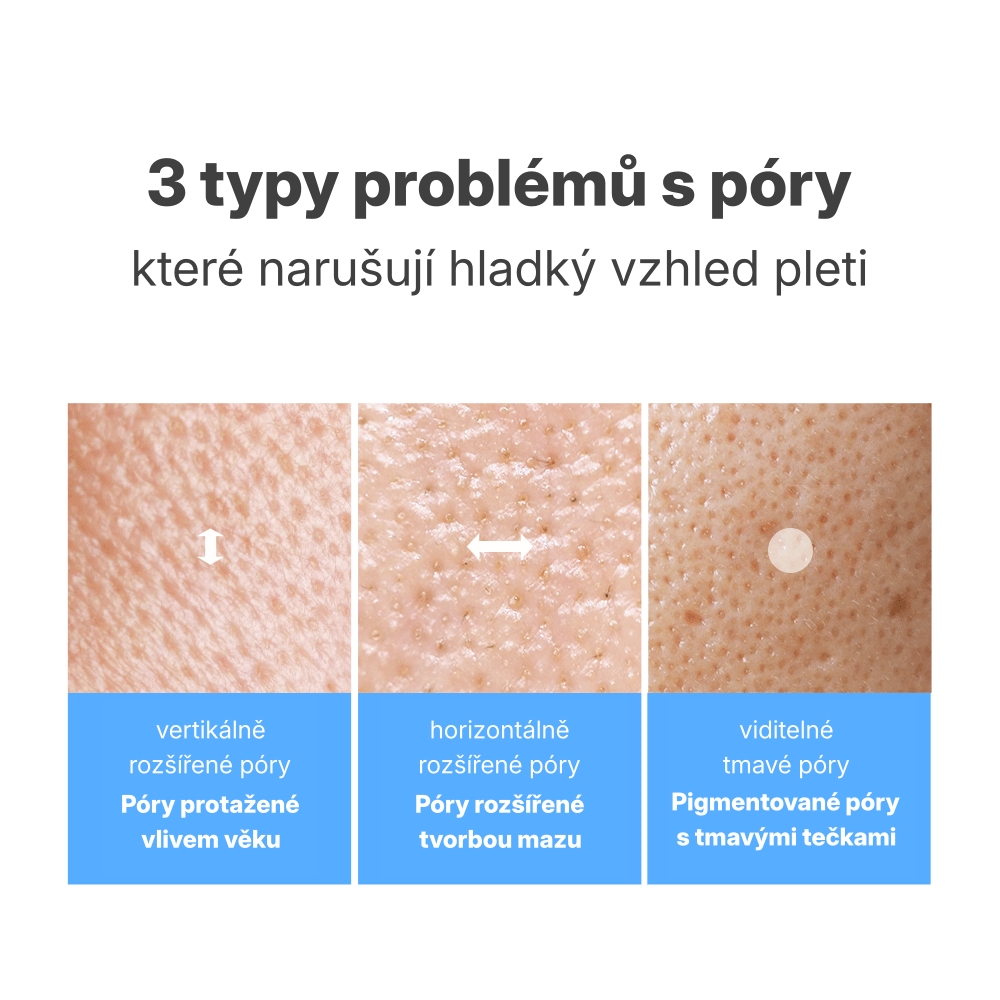 1.1. Detailed Page APERIRE Be Frozen Pore Ampoule